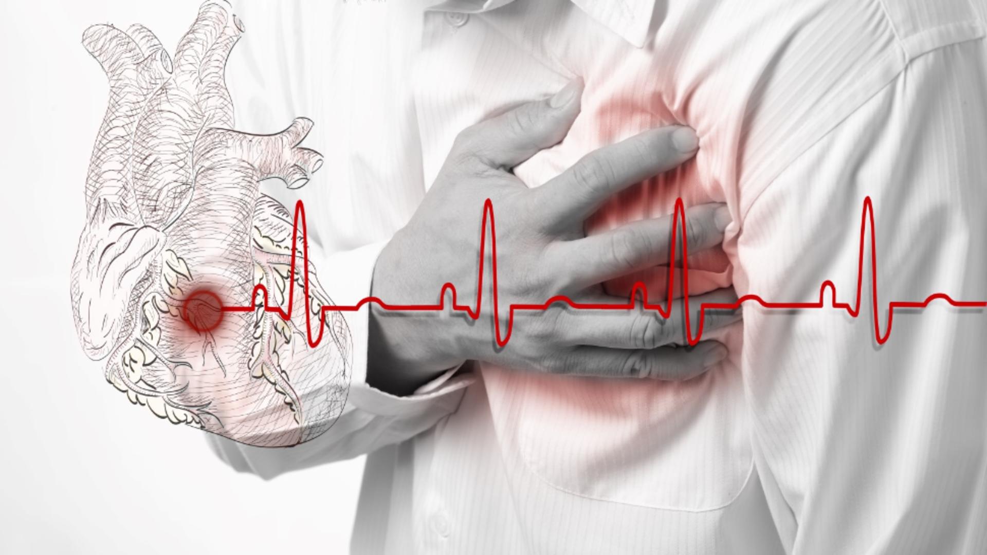 SIMPTOMELE pe care le ignori până când e prea târziu: Primele semne ale insuficienței cardiace - 9 din 10 români nu le știu