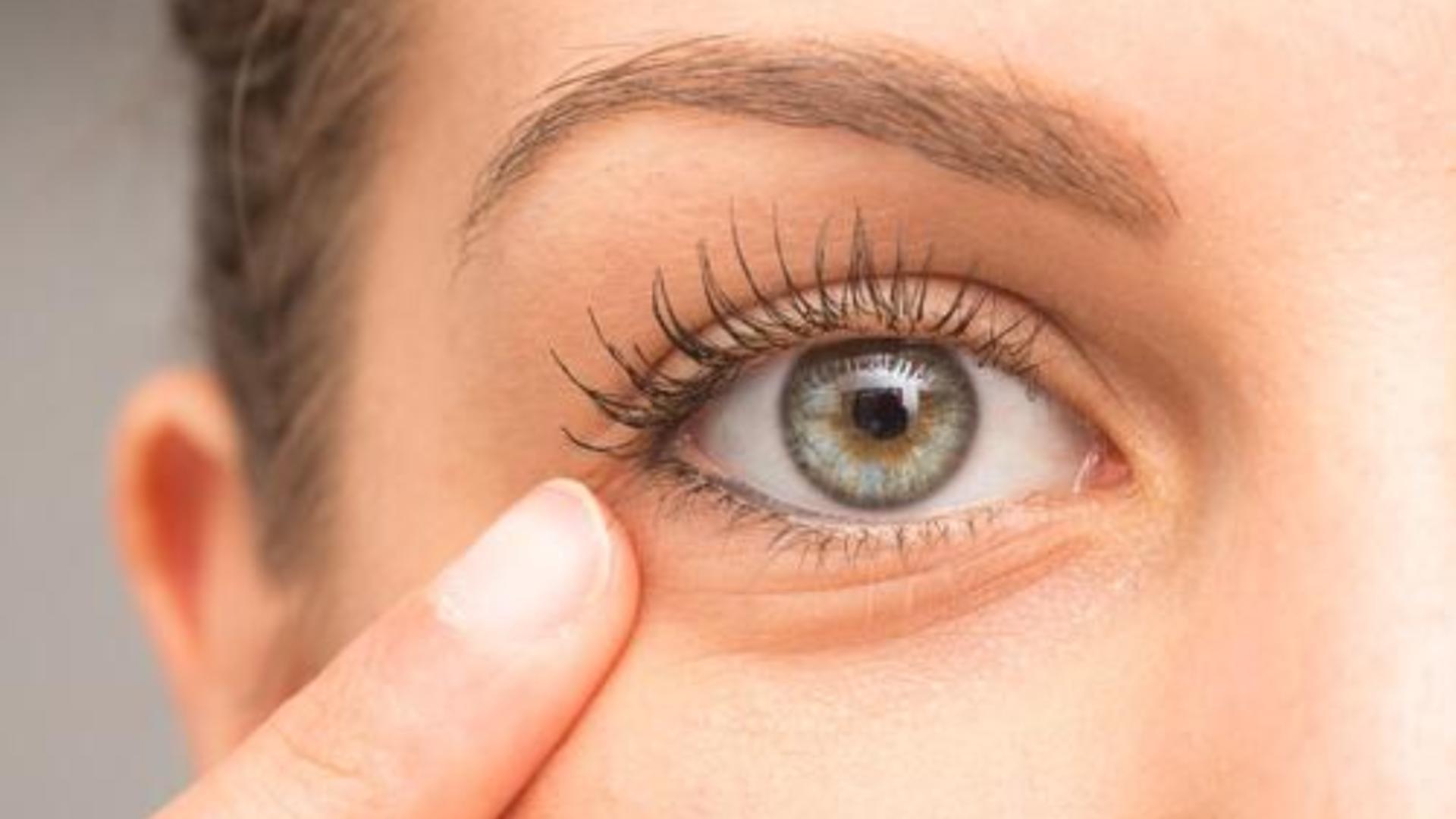 Ai cearcăne și ochii obosiți? Remediile naturiste  care te ajută să îți recapeți strălucirea din priviri