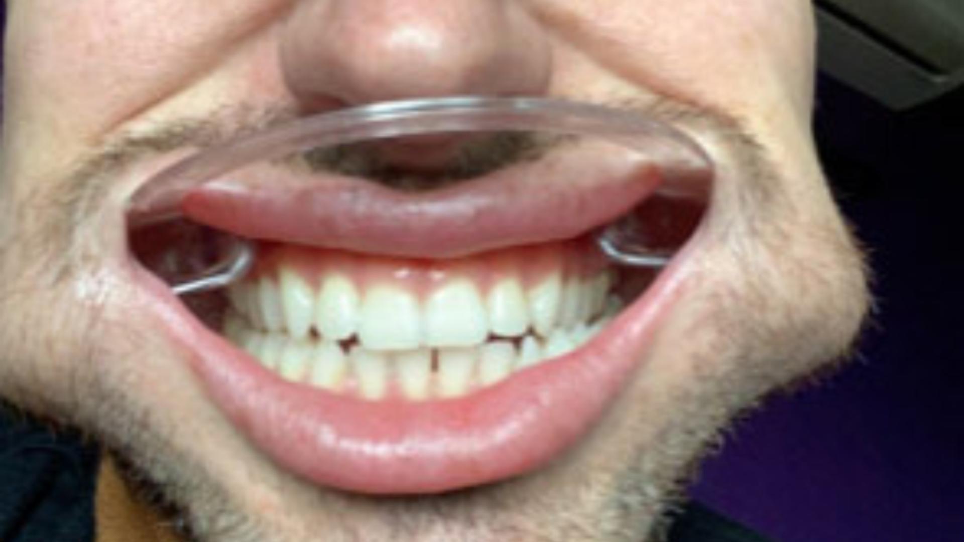 Ideea creșteri unor dinți noi e visul oricui (foto: Profimedia)
