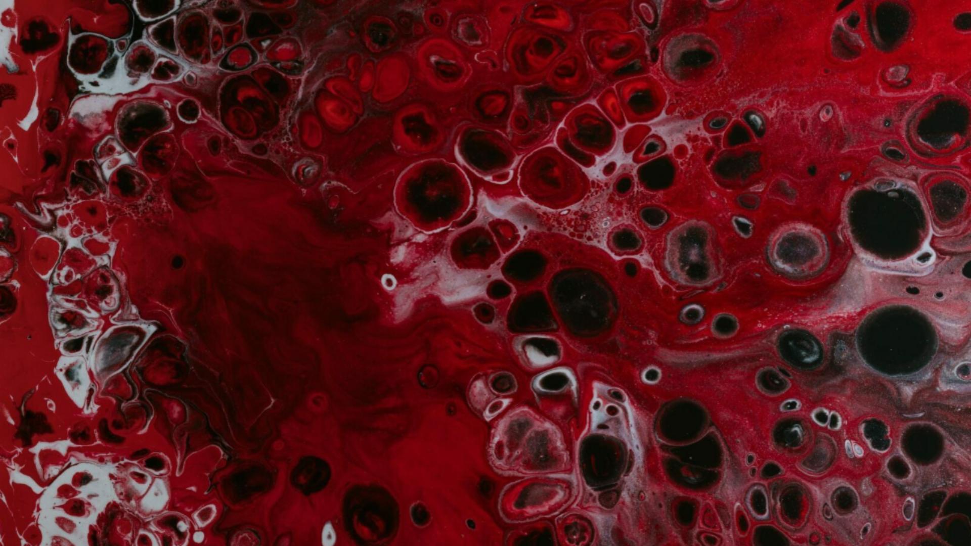 2 remedii naturale pentru a curăța rapid sângele – Cum scapi de toxinele care îți aduc boli grave
