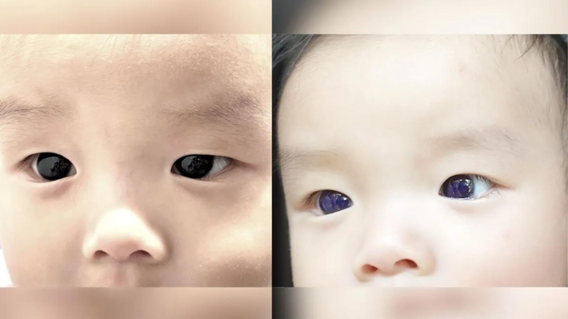 Ochii micuțului nu numai că și-au schimbat cukloarea, dar au devenit și strălucitori (http://creativecommons.org)