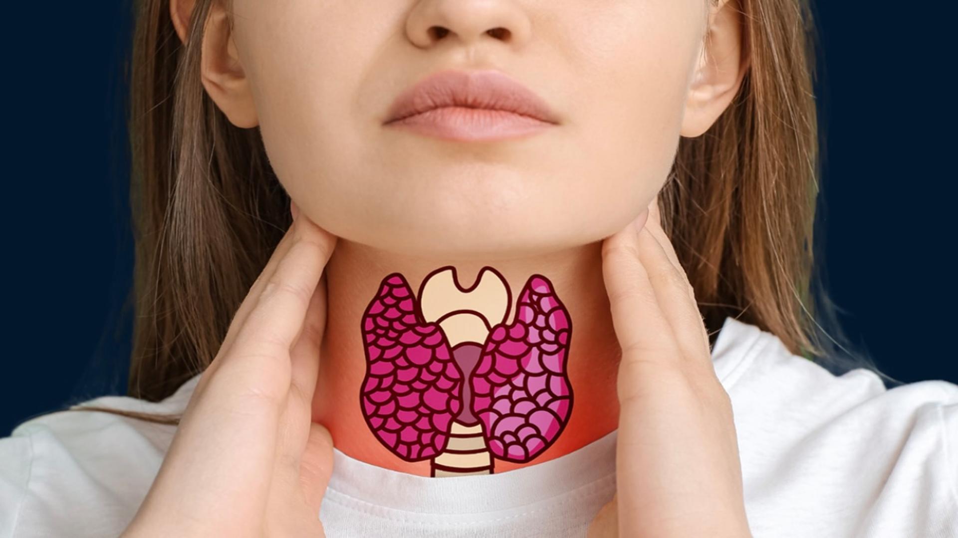 Alimentele care îți îmbolnăvesc glanda tiroidă: producția de hormoni, grav afectată