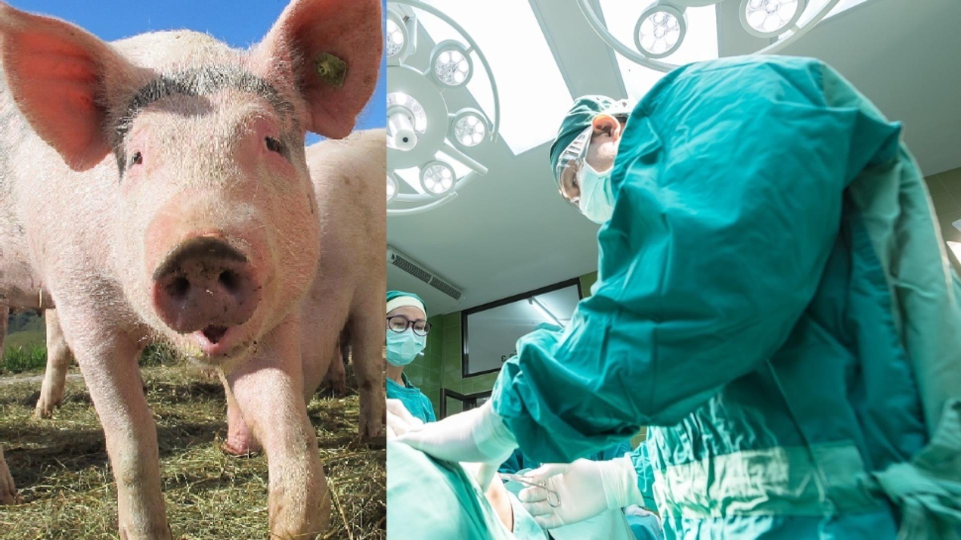 Primul transplant de rinichi de la porc la om a fost realizat cu succes
