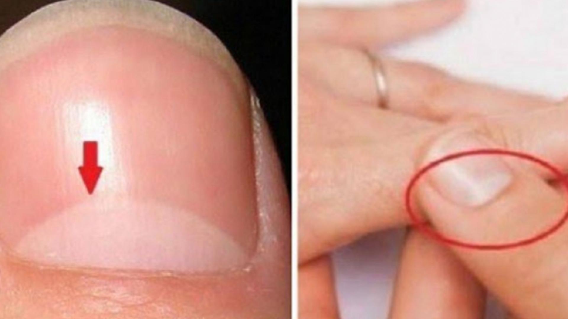 Ce semnifică semiluna albă de pe unghiile tale