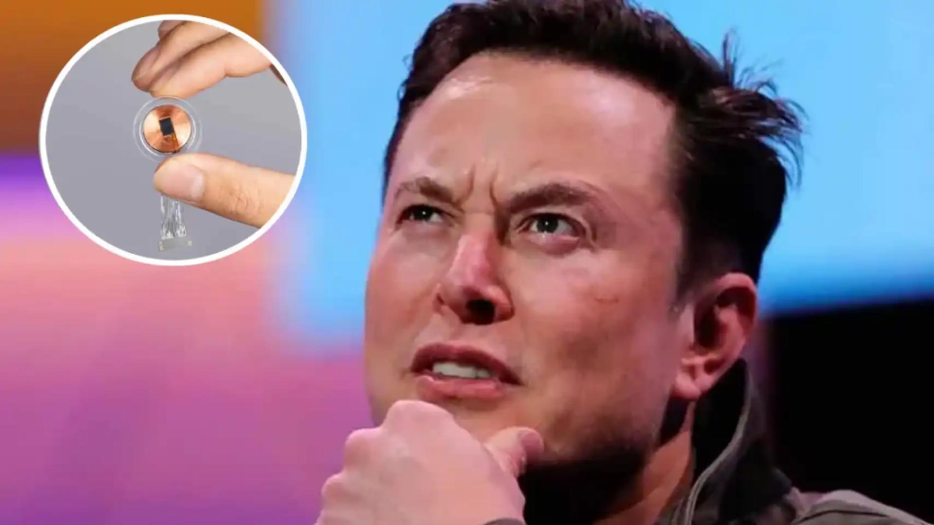 Implantul cerebral al lui Elon Musk s-a stricat în creierul pacientului