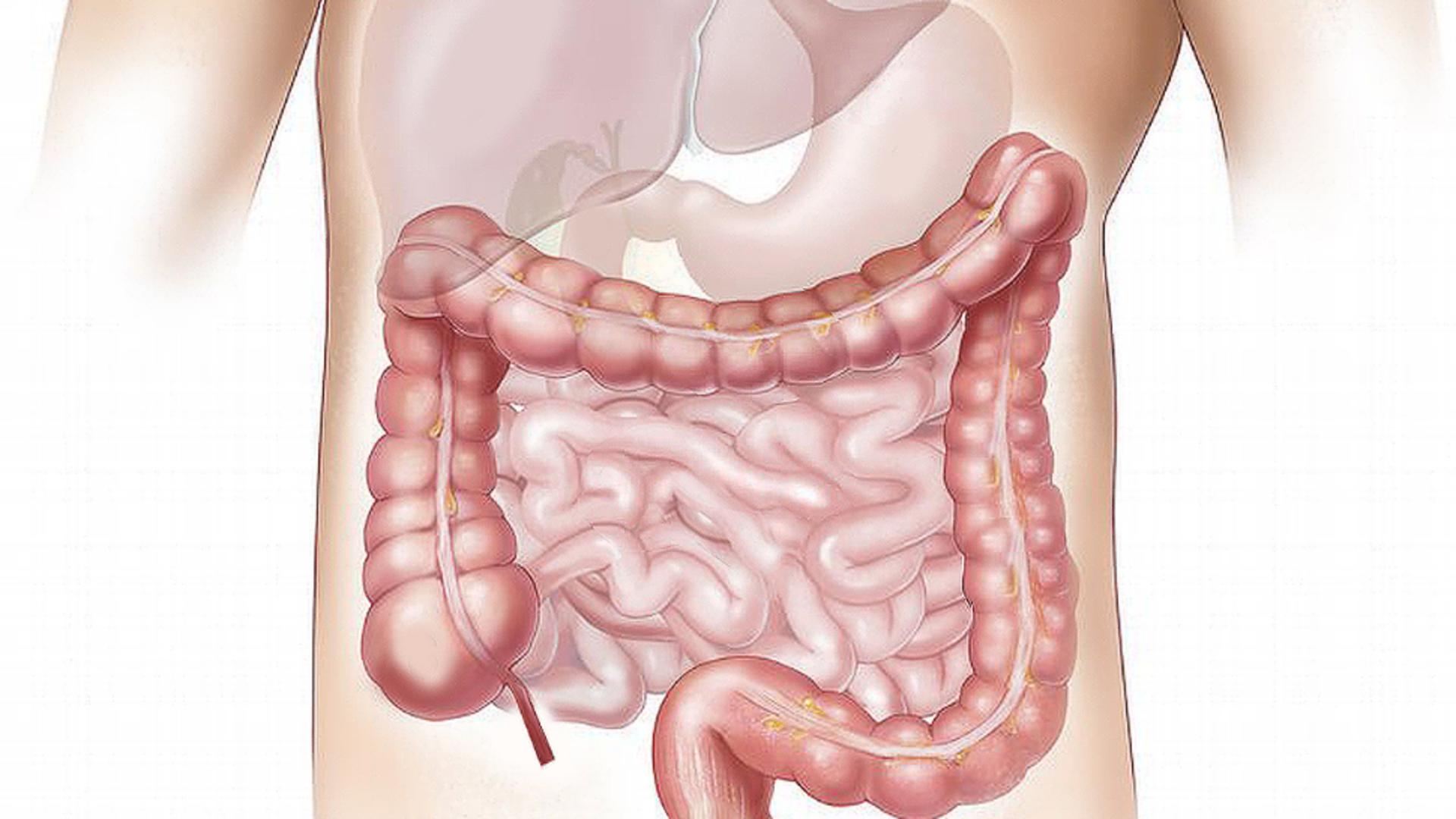 Primele simptome ale cancerului de colon. Semnele care trebuie să te trimită la doctor