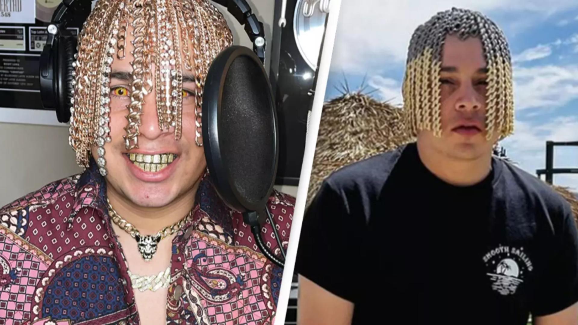 Un rapper care și-a implantat lanțuri de aur în cap, care să semene cu părul, a pus pe jar medicii. Foto: Unilad