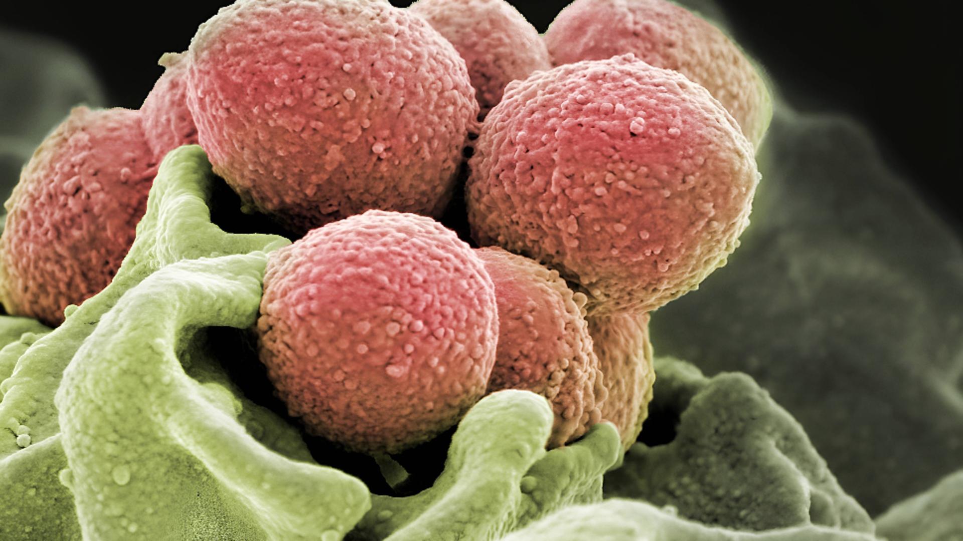 Bacteria provoacă infecții deosebit de grave (Profimedia)