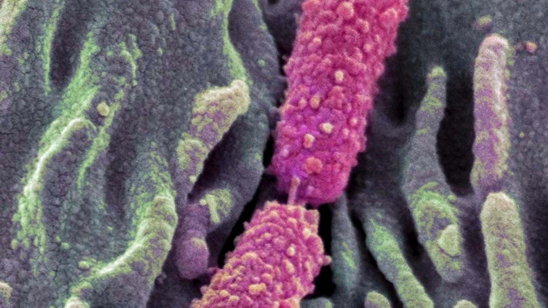 Majoritatea tulpinilor de E. coli sunt inofensive