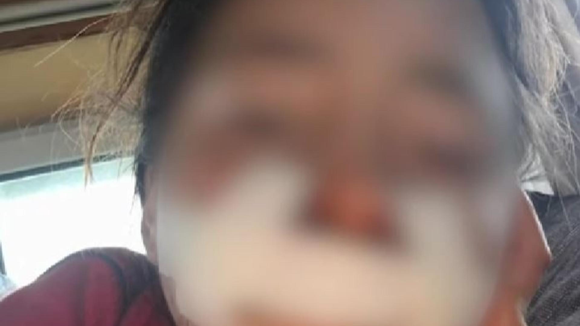 Coșmar în familie: doi frați din Arad au fost bătuți și înfometați de proprii părinți. Tatăl le-a cusut rana cu o sfoară