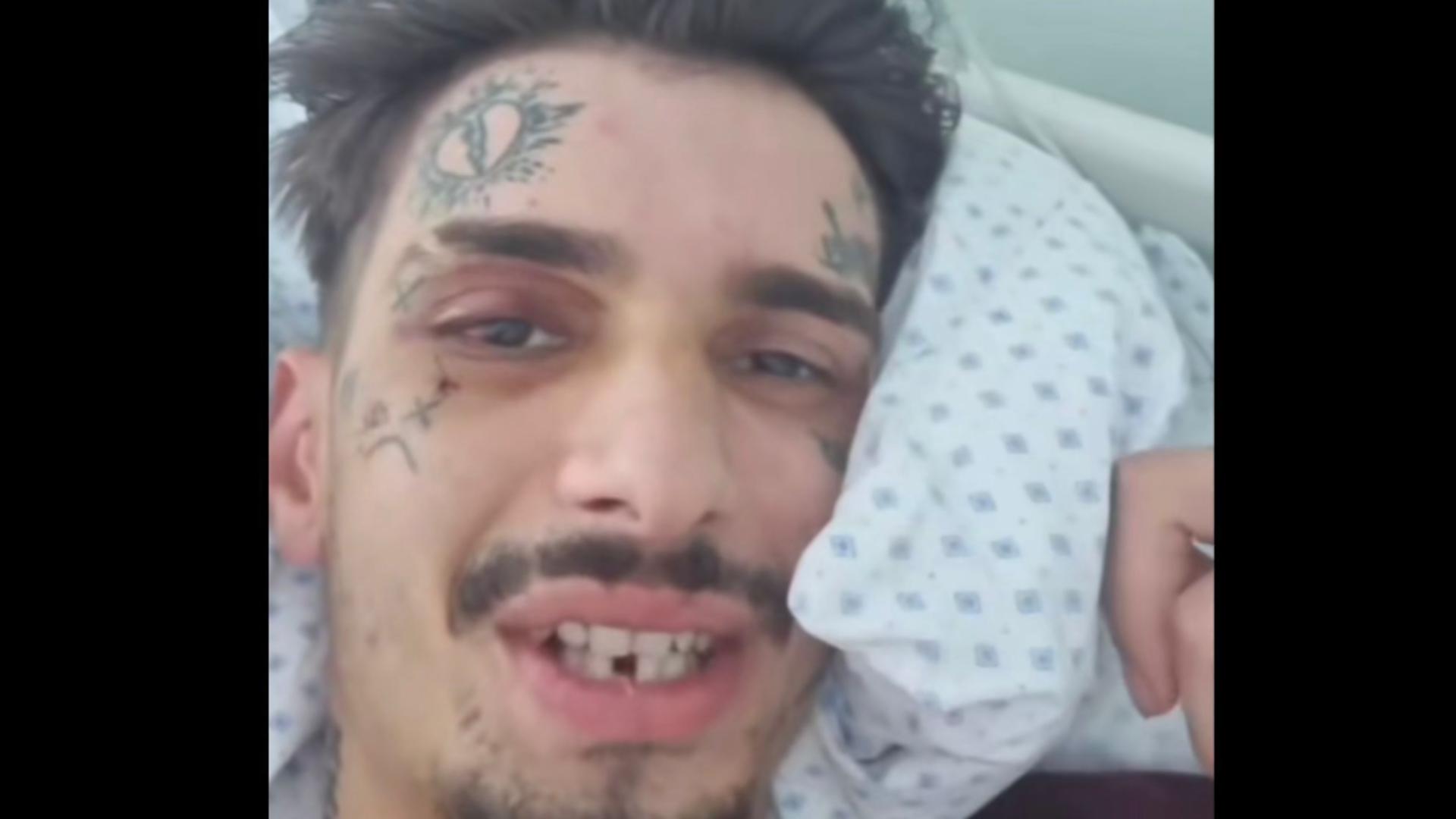 Artist de 23 de ani, mort la doar 23 de ani. A fost bătut crunt în urmă cu  un an, la un festival de pe Litoral