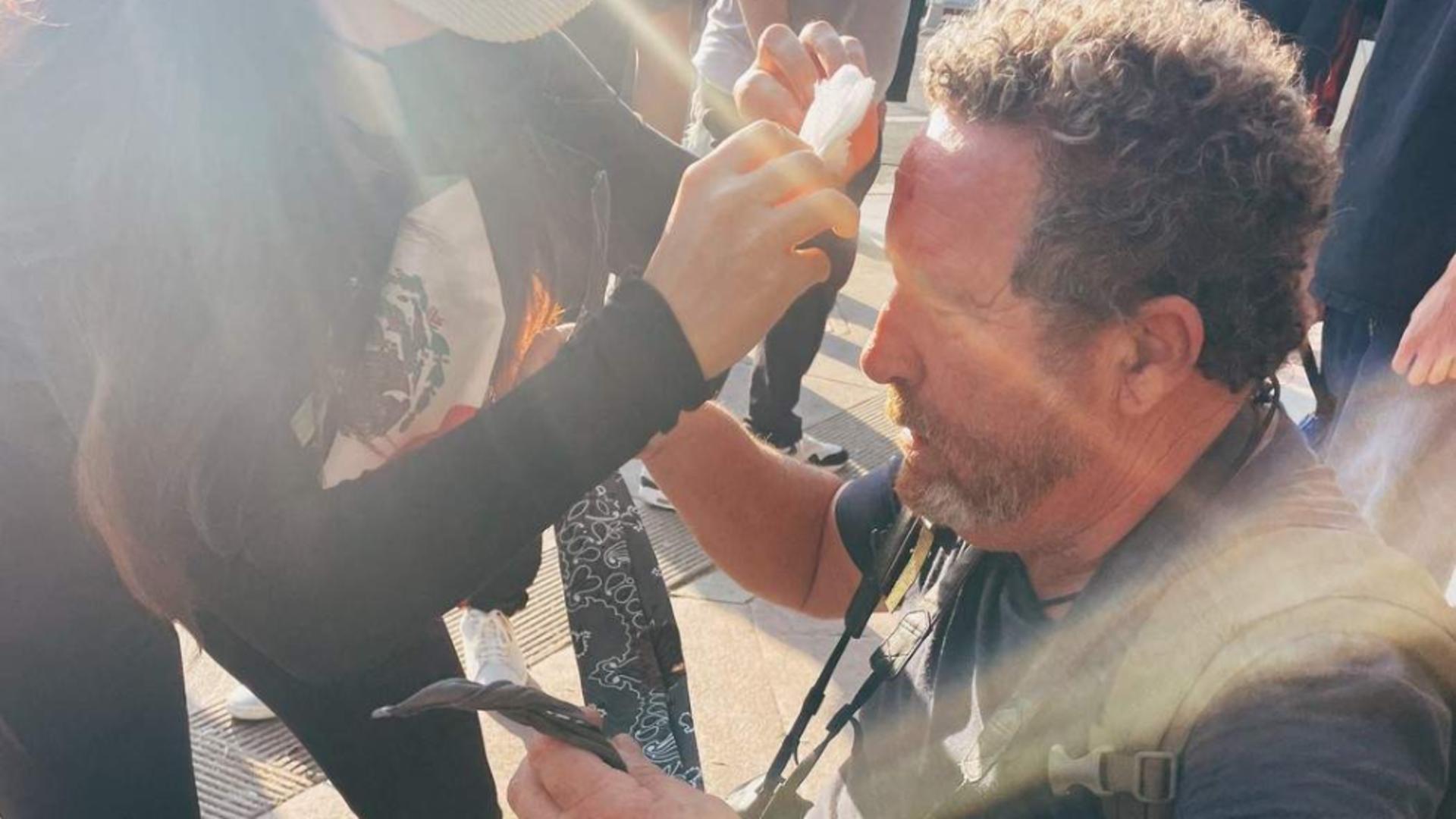 Al doilea jurnalist rănit de forțele de ordine în timpul protestelor din Los Angeles: „Am fost o țintă ușoară”