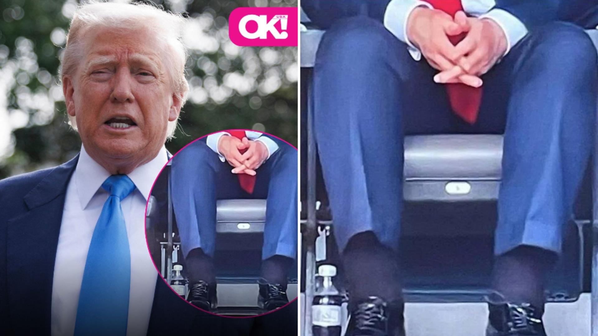 Semnele de pe mâna lui Donald Trump pun specialiștii pe gânduri. „Nu își tratează bine diabetul de tip II”