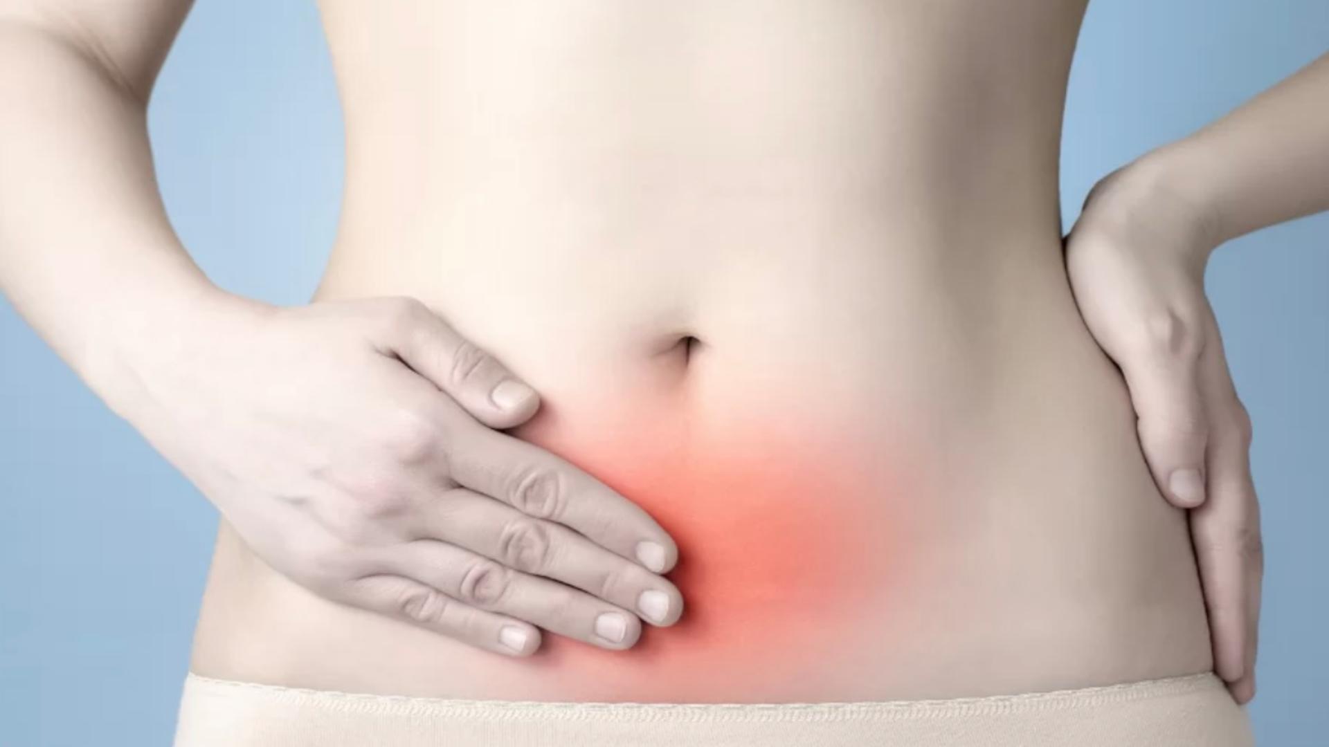 Boala ginecologică în care apar durerea și infertilitatea