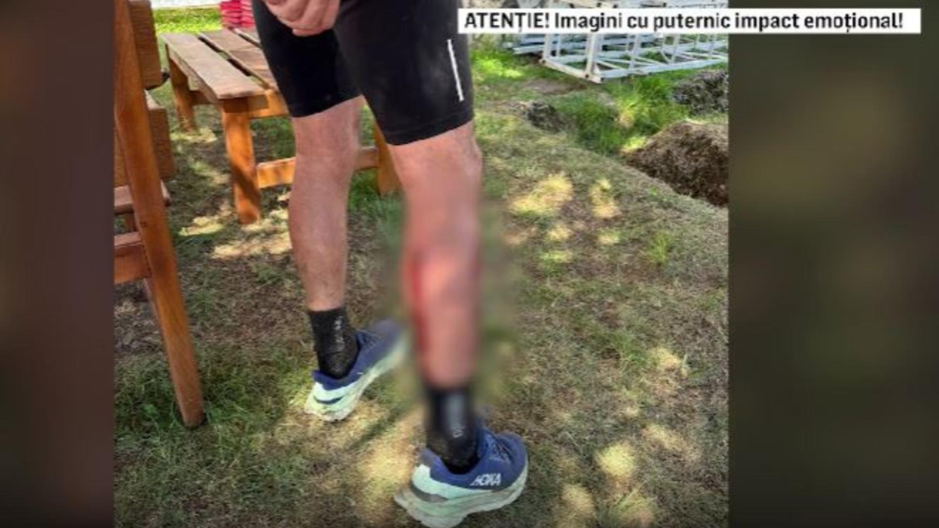 Bărbat atacat de o haită de câini. Alerga în momentul atacului