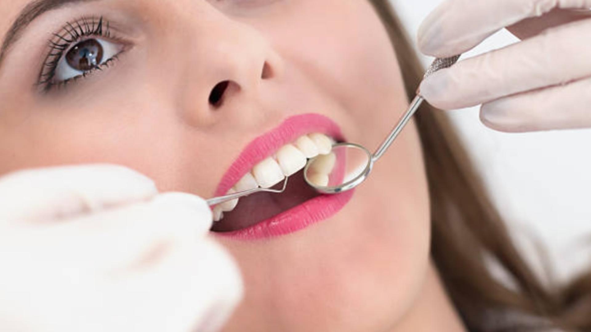 Medicul stomatolog recomandă efectuarea unui detartraj dentar o dată sau de două ori pe an, în funcție de nevoi