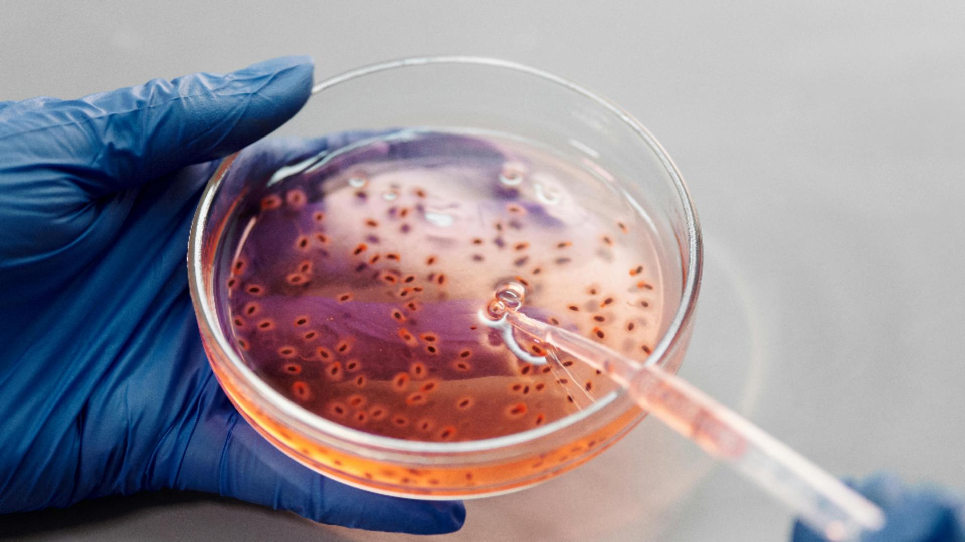 Un bărbat a murit de ciumă. Ultimul caz a fost raportat în anul 2007