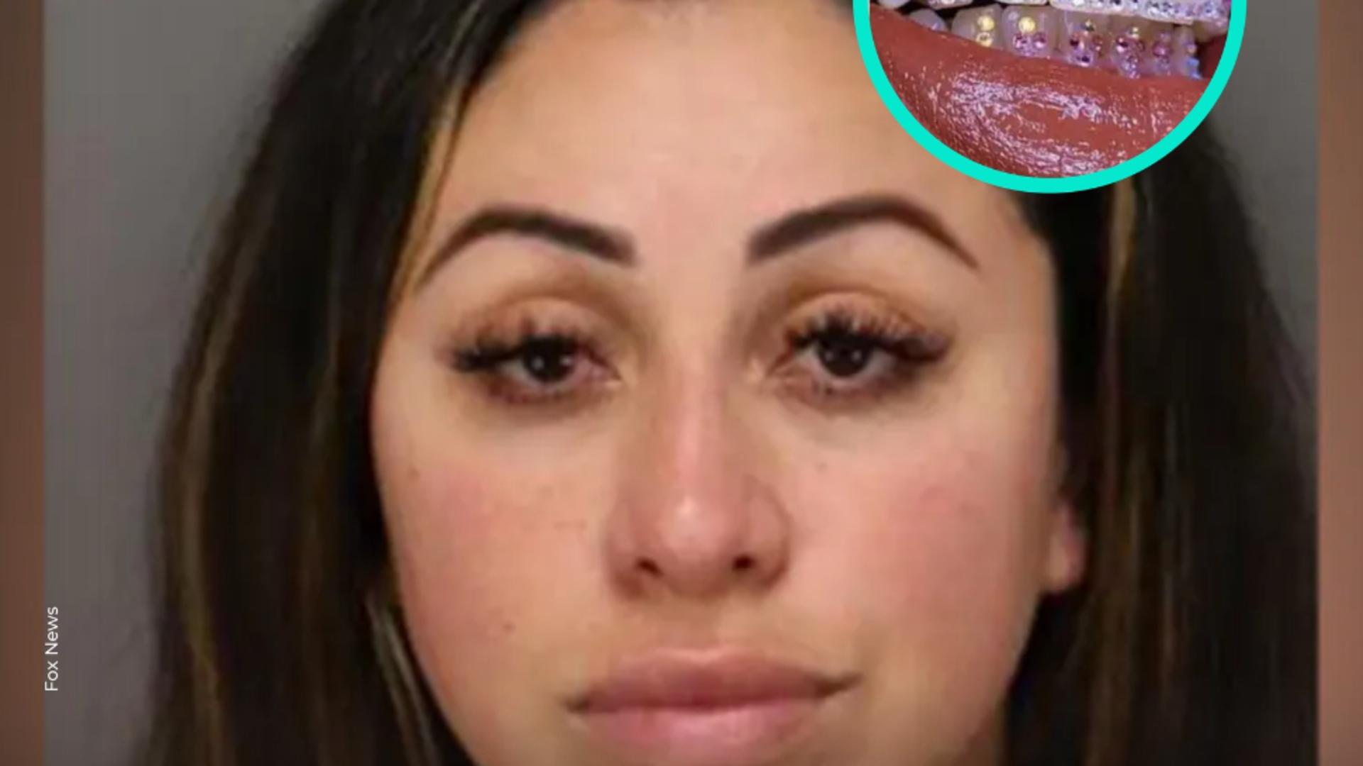 Stomatologie practicată ilegal. O femeie de 35 de ani a fost arestată după ce a instalat fațete dentare false folosind „superadeziv” în loc de adezivi medicali