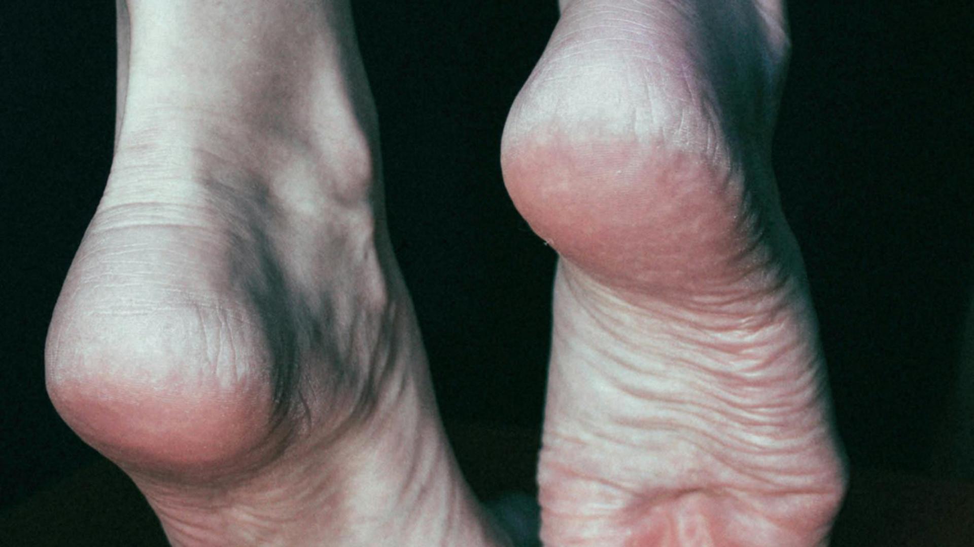 Remediul din bucătărie care te scapă de călcâiele crăpate. Este vorba despre un singur ingredient care îți va face pielea fină și moale