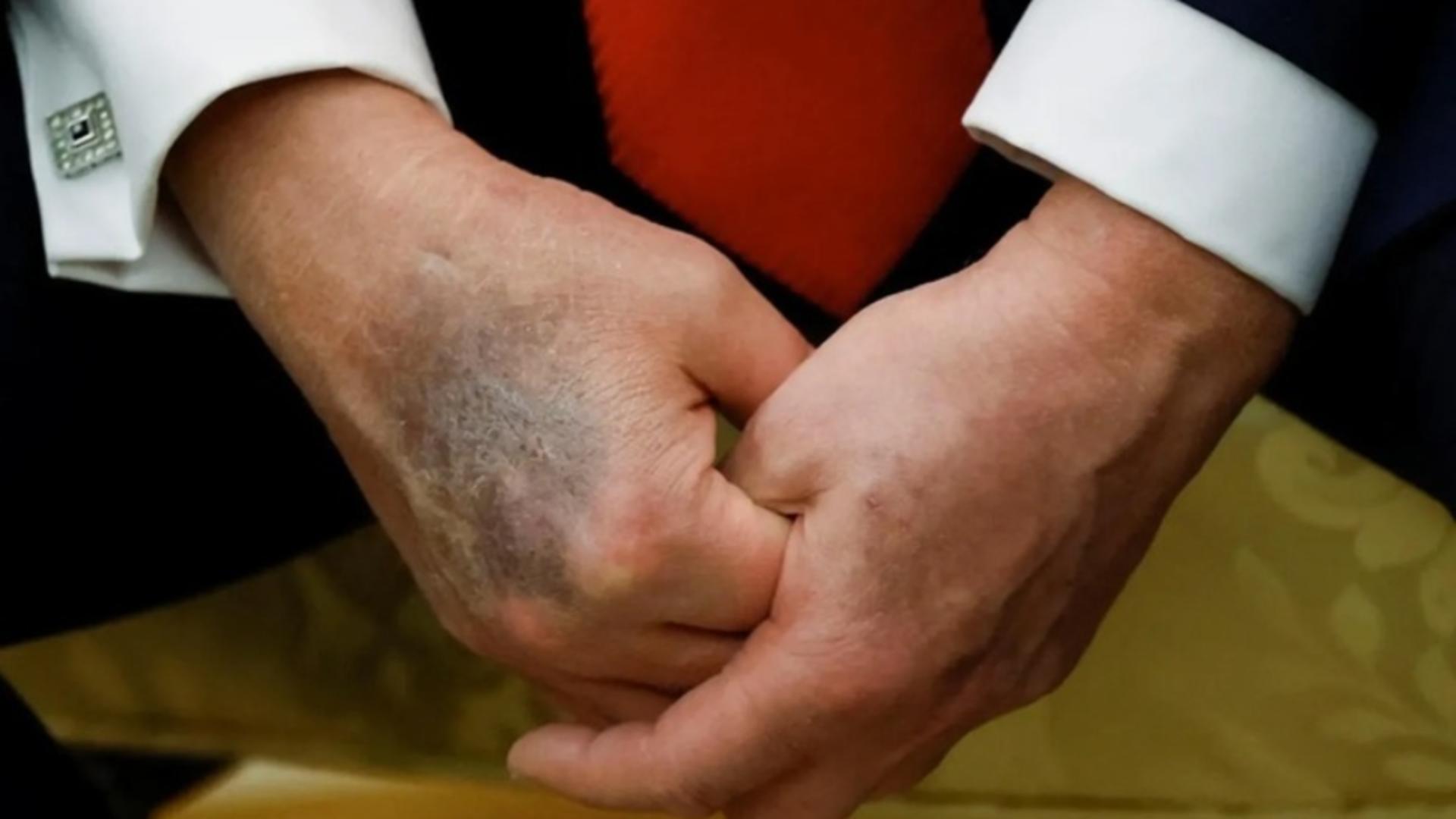 Zvonuri despre moartea lui Donald Trump agită rețelele sociale. Casa Albă nu comentează, iar J. D Vance face afirmații stranii