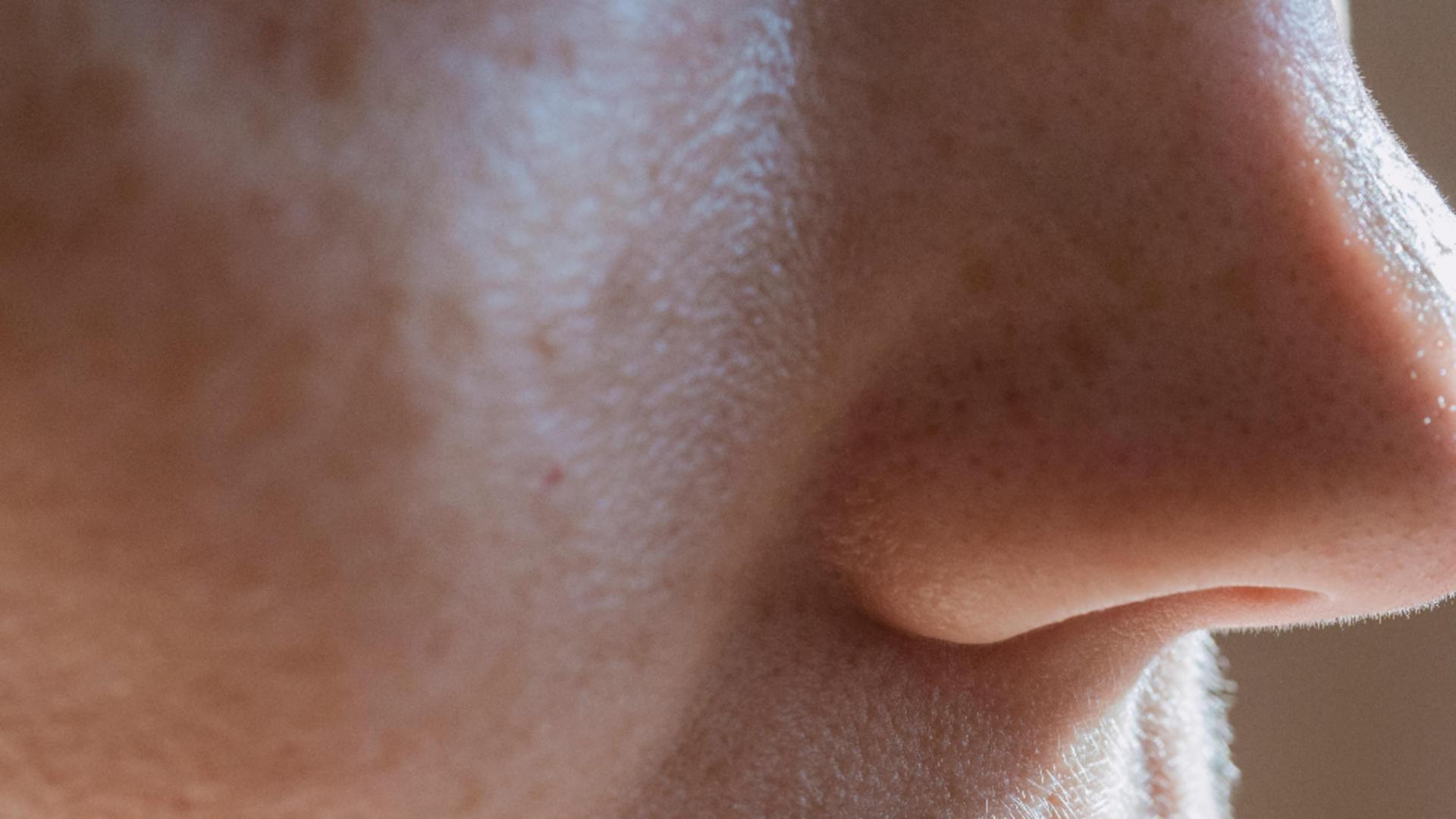 Cum să scapi de punctele negre de pe nas. Ingredientul din bucătărie care curăță tenul