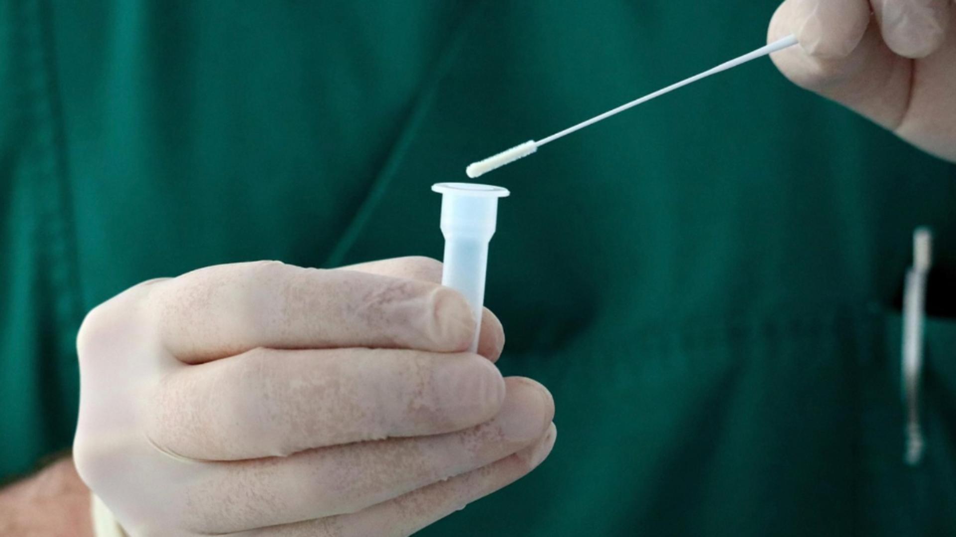 Testul care poate diagnostica sute de alergii