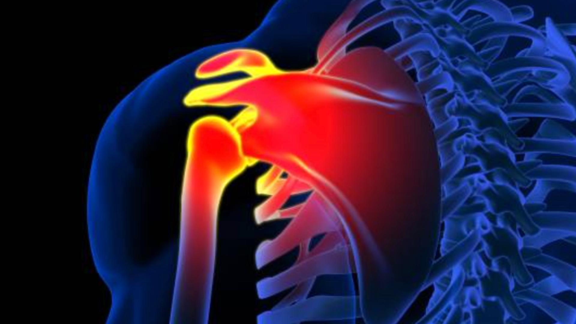 Ce facem dacă ne doare umărul