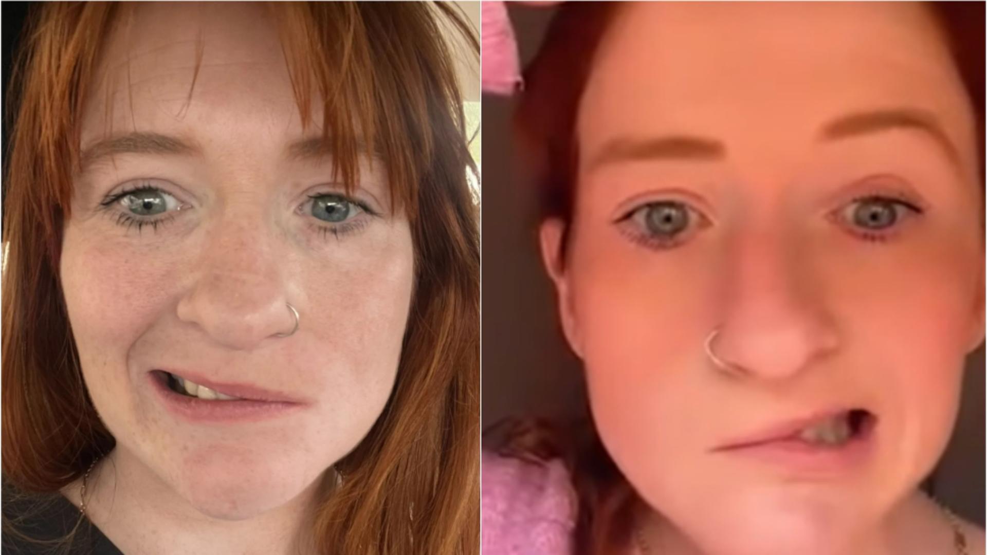 Durerea unei tinere mame! A paralizat pe jumătate de față după o băutură banală: „Viața mea s-a schimbat complet”