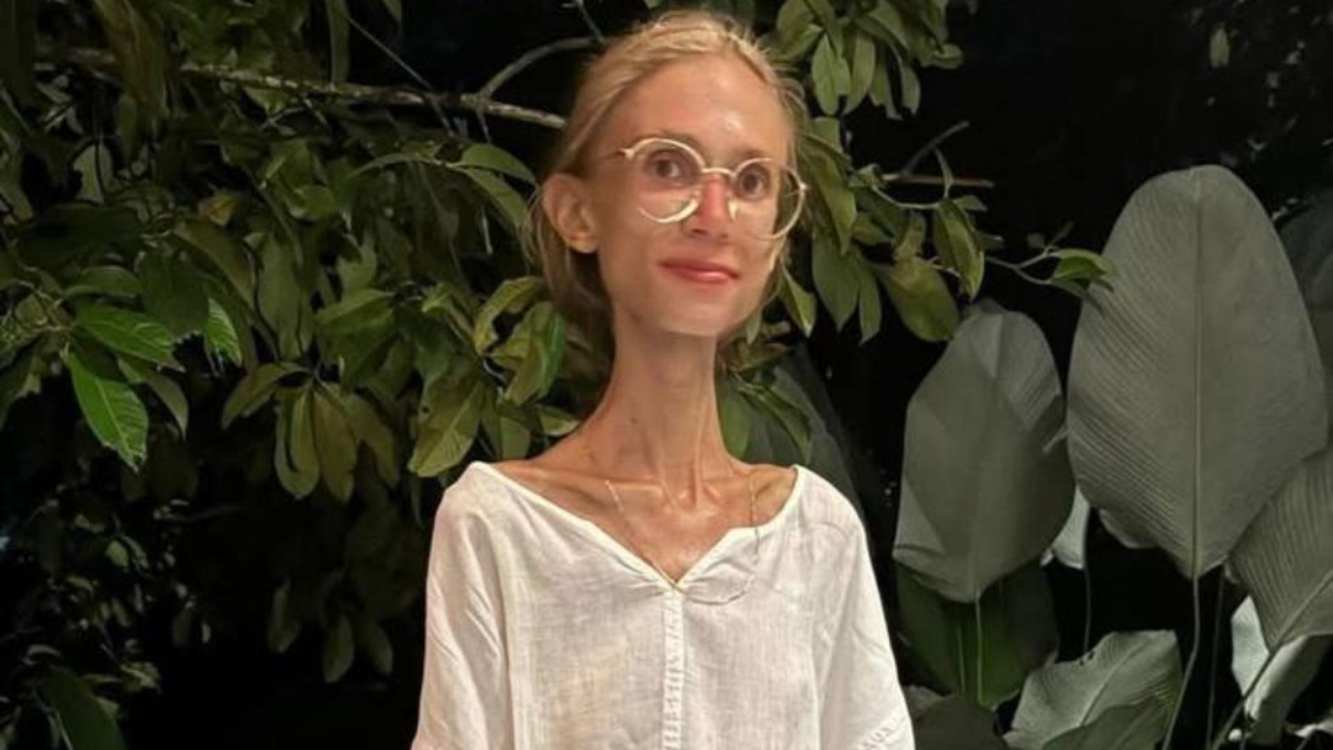 Tânără poloneză moartă după o dietă extremă bazată doar pe fructe crude. Avea doar 22 de kilograme