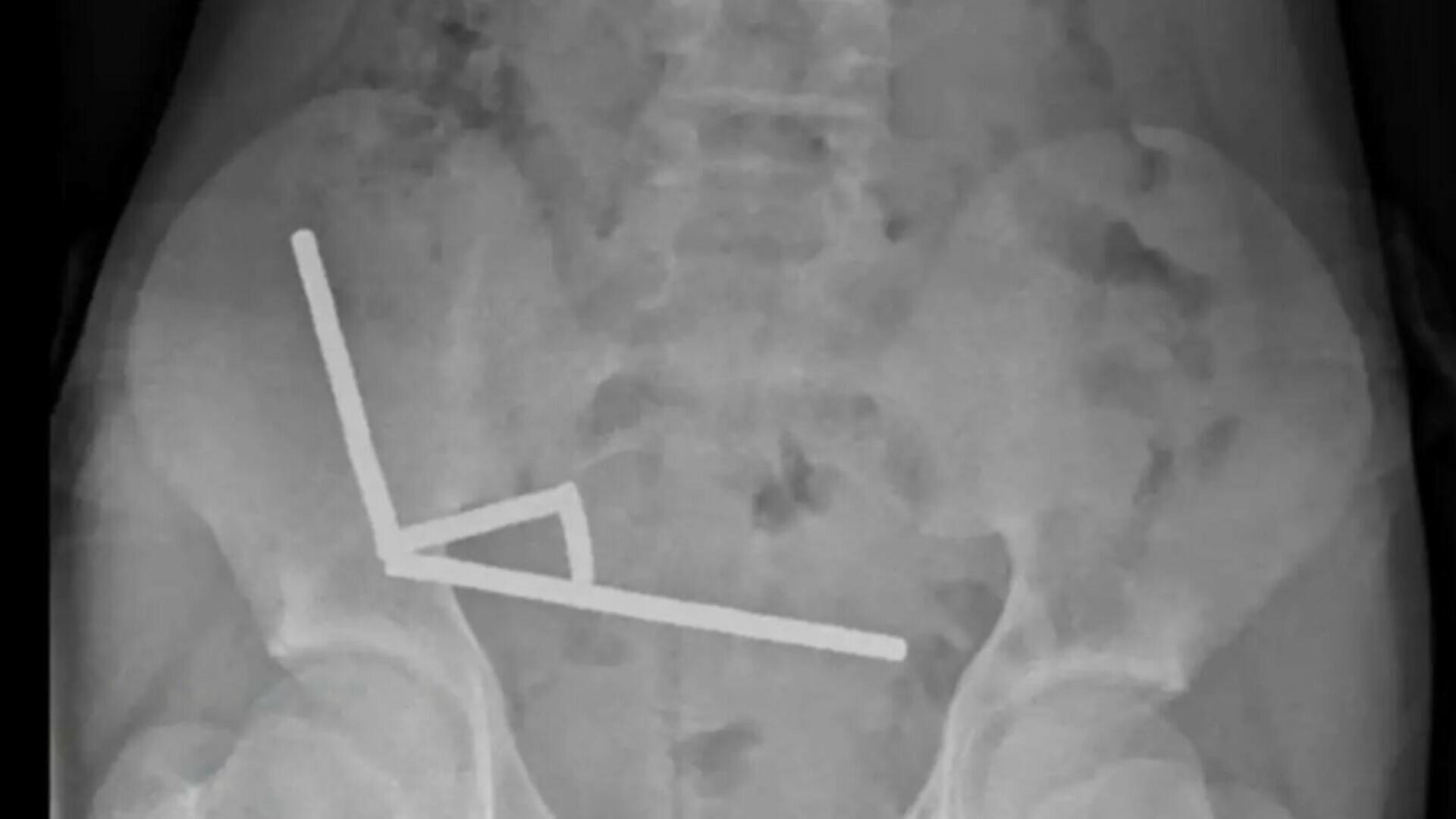 Caz șocant în Noua Zeelandă