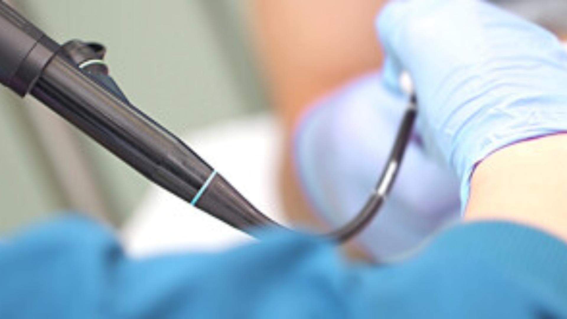 Bronhoscopia permite medicului să examineze traheea și bronhiile cu ajutorul unui tub subțire dotat cu cameră video