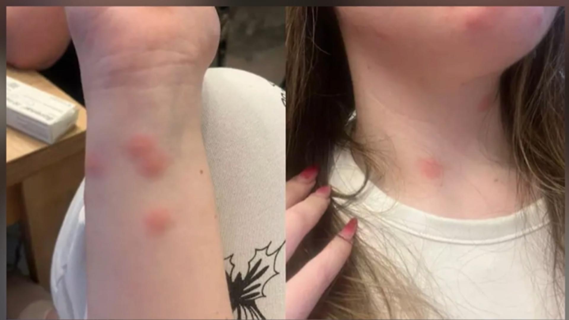 Condiții jalnice în trenul București–Sighet. O tânără a ajuns la spital după ce a fost mușcată de ploșnițe într-un vagon cușetă