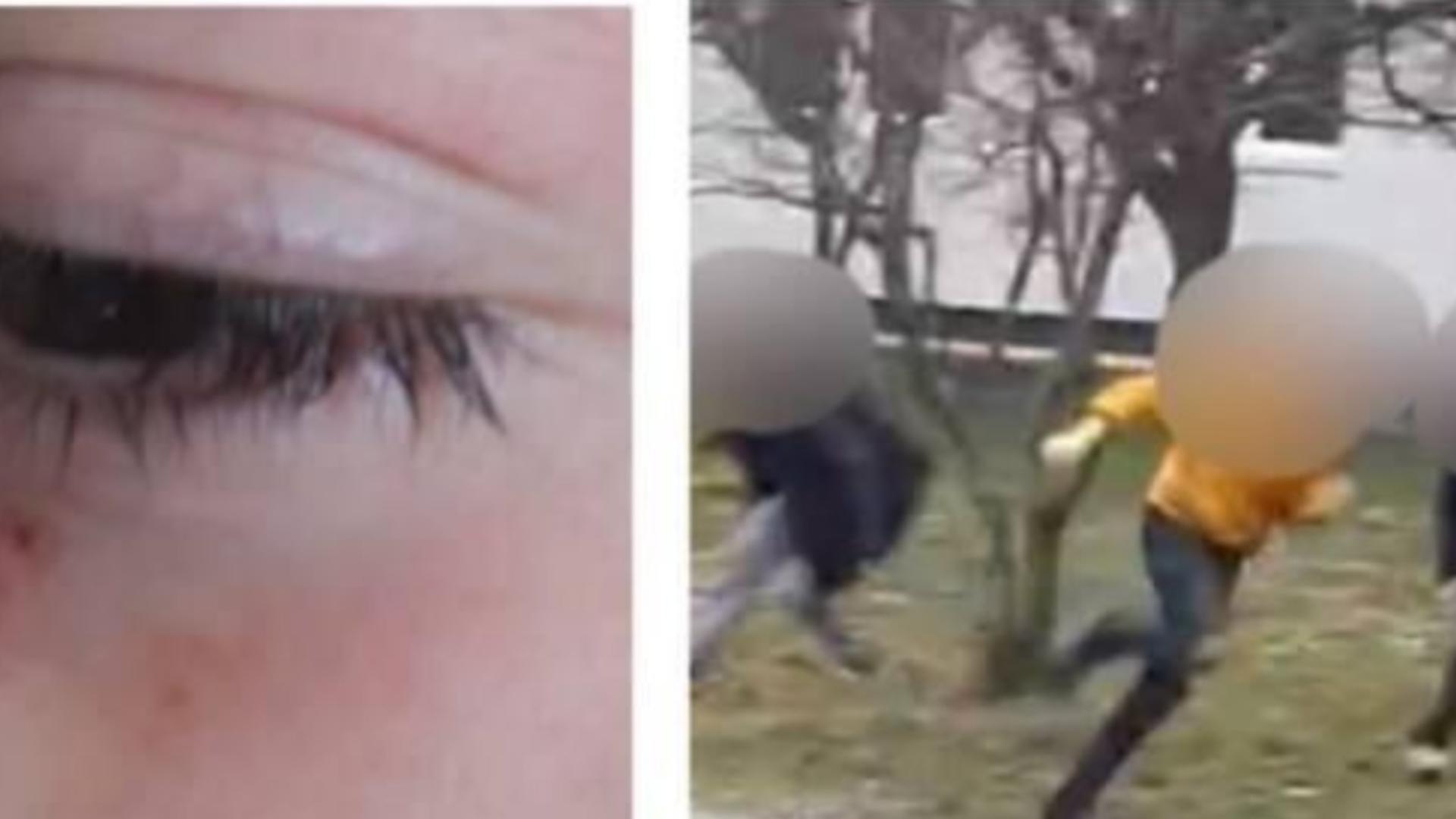 Elev din Maramureș, bătut de două colege. Mama băiatului a sunat poliția.