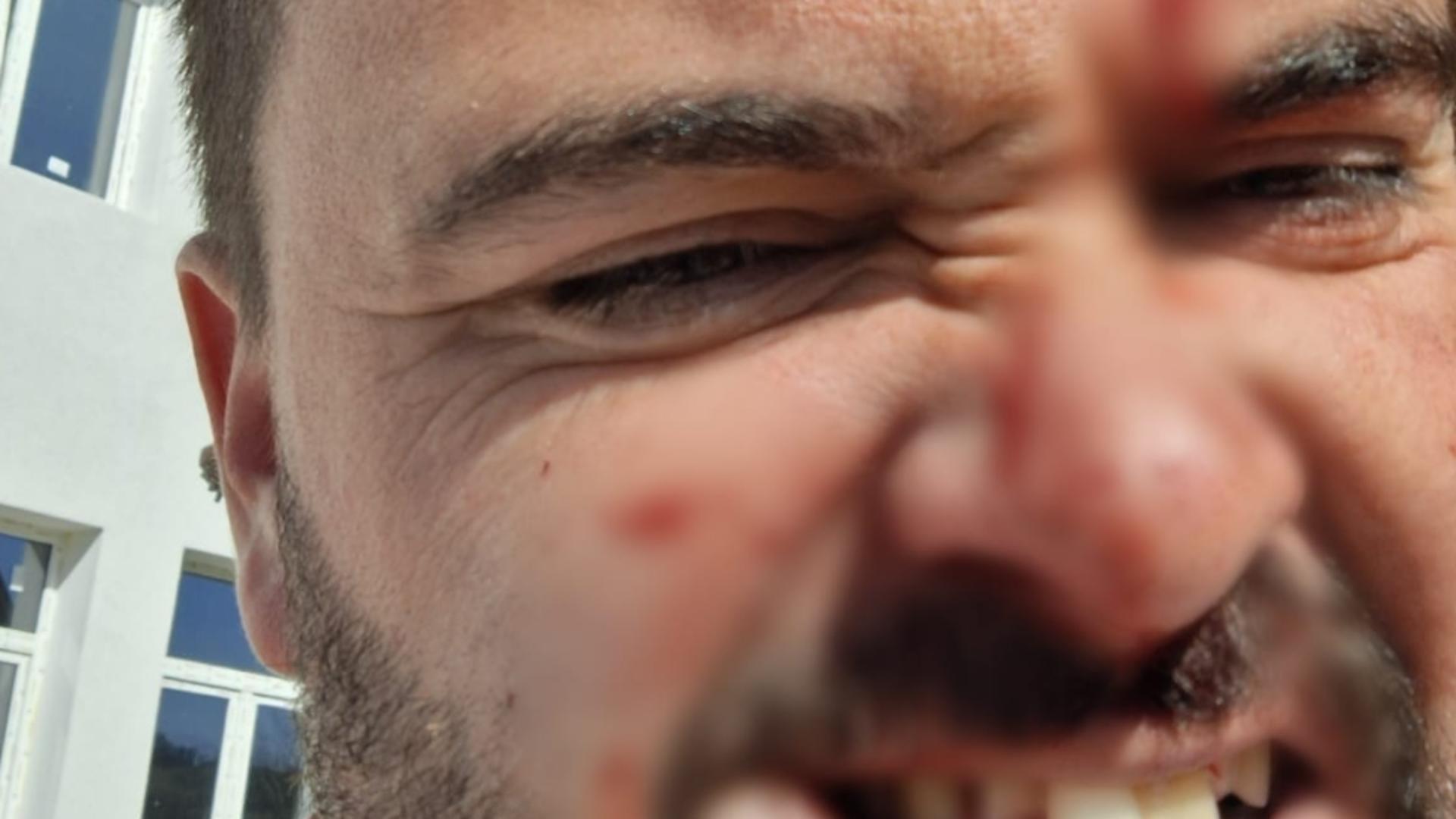 Antrenor bătut cu pumnii si picioarele la un meci de fotbal de juniori. Sursa foto: Bihon.ro.