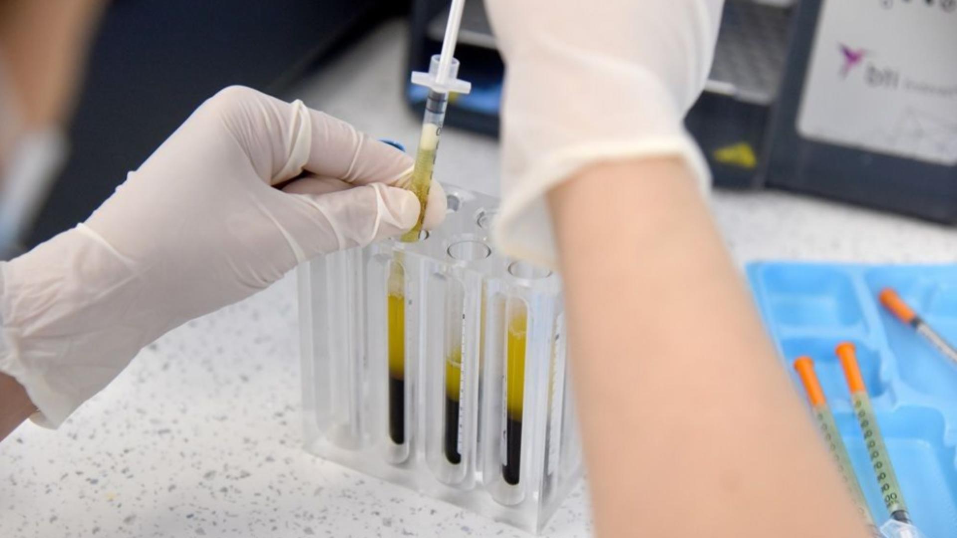 Infiltrații cu PRP / SANADOR